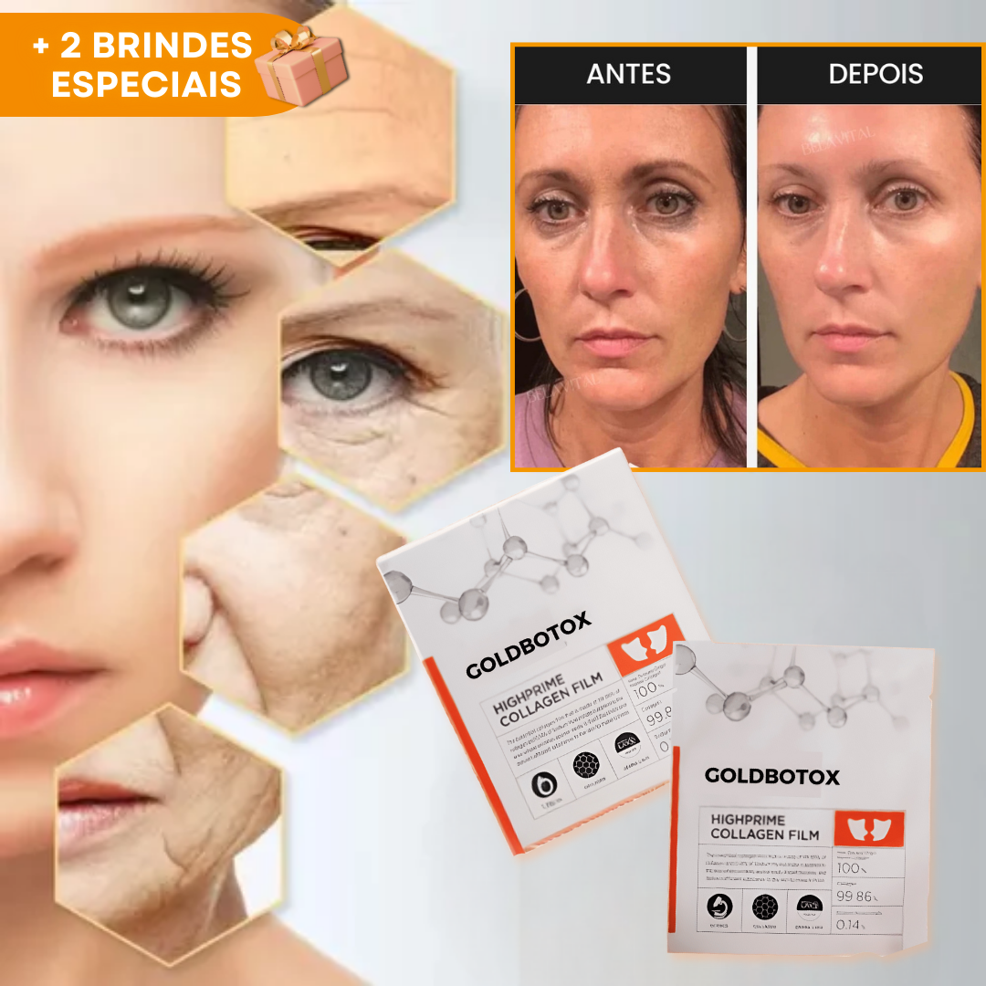 Kit  GoldBotox Highprime - Colágeno + Ácido Hialurônico [ATIVOS DO BOTOX]